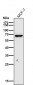 Anti-Estrogen Receptor alpha Rabbit Monoclonal Antibody